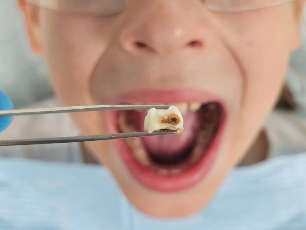  Cane Savannah, SC Emergency Dentist Pros